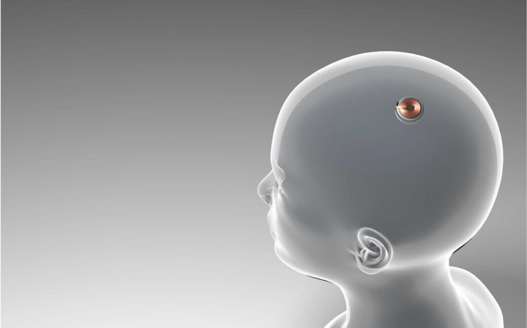 <strong>Neuralink lance les premiers essais humains</strong>